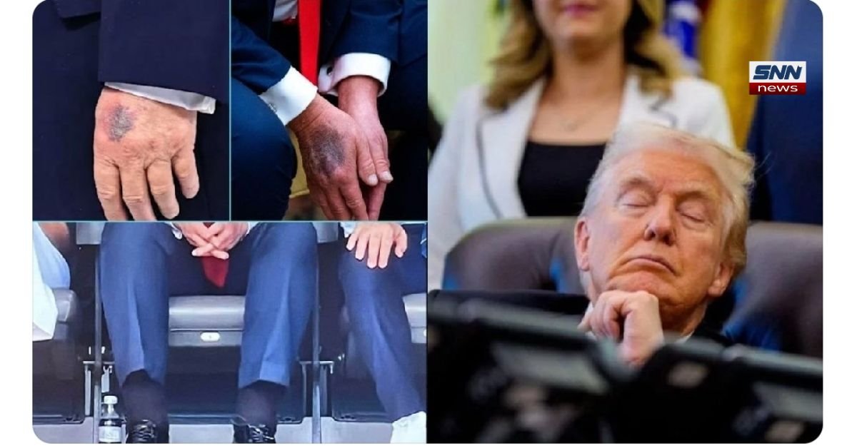Donald Trump during a public speech as German media discusses mental health concerns and behavioral analysis.